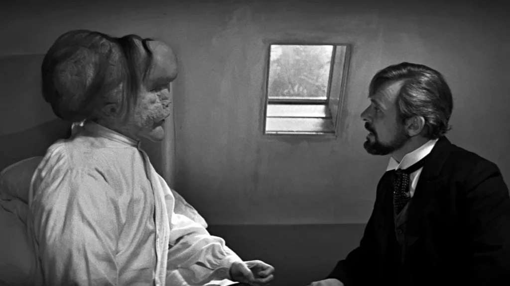 The Elephant Man | foto 4