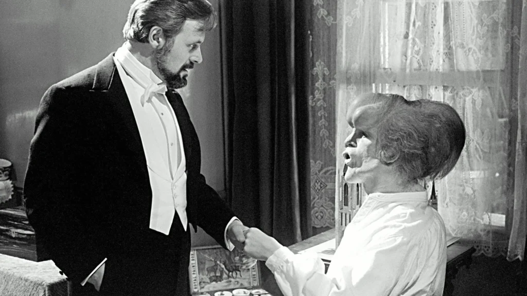 The Elephant Man | foto 5